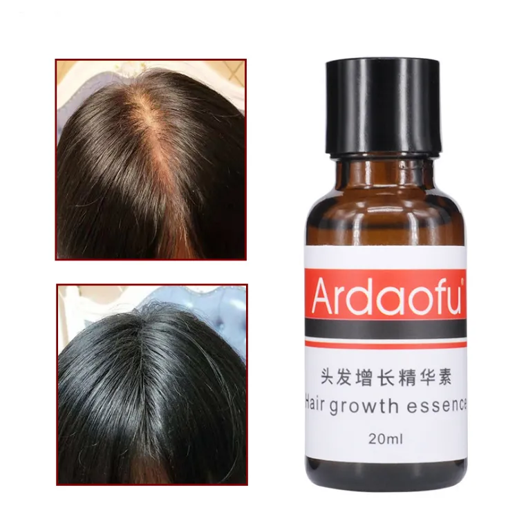 Hair Growth & Hair Loss Prevention – Strengthen & Revitalize Your Hair