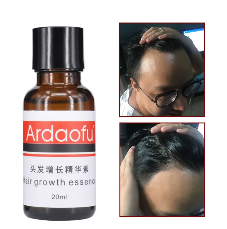 Hair Growth & Hair Loss Prevention – Strengthen & Revitalize Your Hair